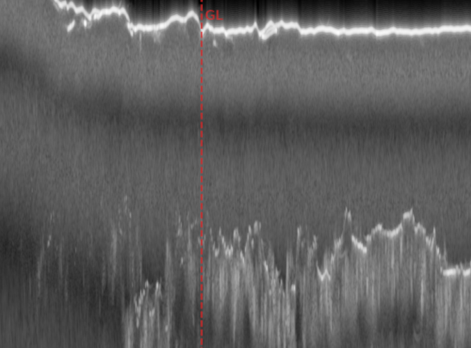 Simualted high-altitude radargram